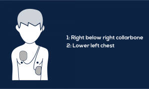 Guide to AED Pad Placement - MDPRO USA